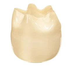 Esther Vase